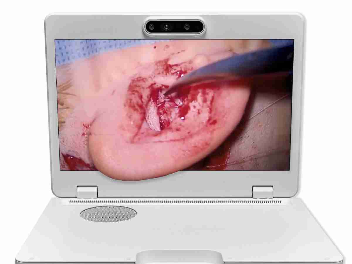 达擎之＂Heads-up 3D显微手术显示系统＂，，，，整合4K裸眼3D显示及眼球追踪系统，，，，具备快速追踪人眼移动位置功能，，，，减轻医师长时间维持固定姿势的负担，，让医师能有更宽广清晰的3D立体视野及更舒适的姿势来执行手术。。。。